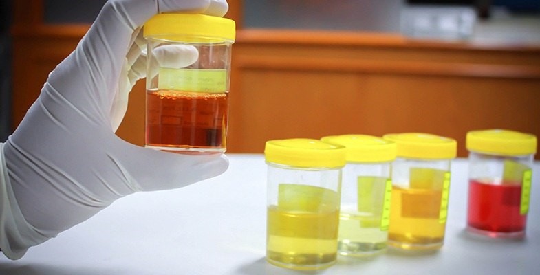 Synthetic Urine Microwave Caraleigh Mills Raleigh NC